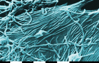 "Ebola virions" by See Source - Charting the Path of the Deadly Ebola Virus in Central Africa. PLoS Biol 3/11/2005: e403 doi:10.1371/journal.pbio.0030403. Licensed under CC BY 2.5 via Wikimedia Commons