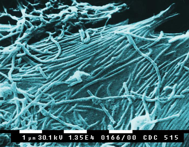 "Ebola virions" by See Source - Charting the Path of the Deadly Ebola Virus in Central Africa. PLoS Biol 3/11/2005: e403 doi:10.1371/journal.pbio.0030403. Licensed under CC BY 2.5 via Wikimedia Commons